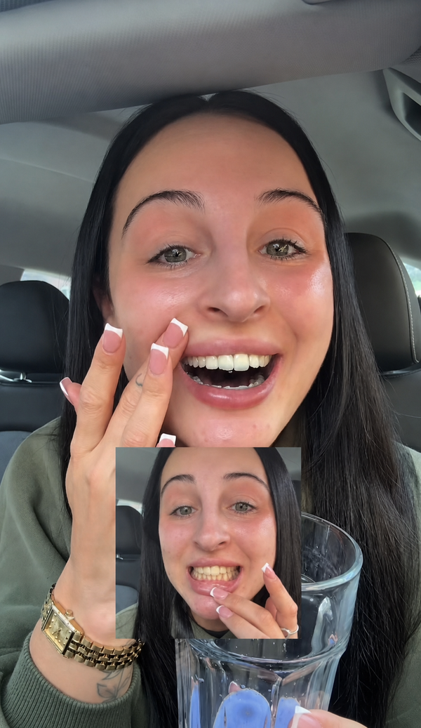 Real Smiles, Real Results