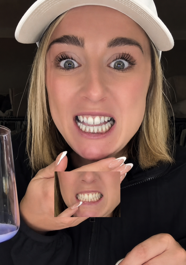 Real Smiles, Real Results