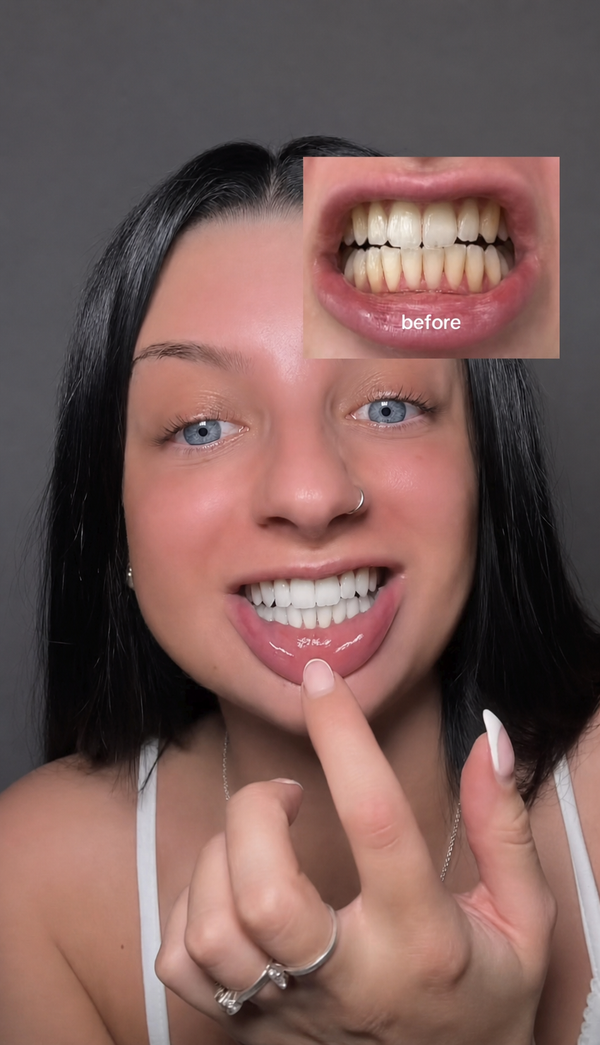 Real Smiles, Real Results