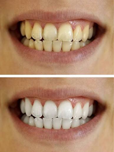 <p><strong>Everyday People. Confident Smiles</strong></p>